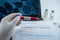 新たに進化した「エムポックス変異株」を確認、英国保健当局が報告