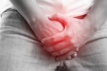 完治不可能なのに軽視されがちな性病「性器ヘルペス」が増加傾向