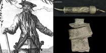 伝説の海賊「黒ひげ」の船で発見されたゾッとする医療機器