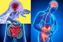 ”病気の記憶”だけで炎症は再発することがある「病は気から」を研究