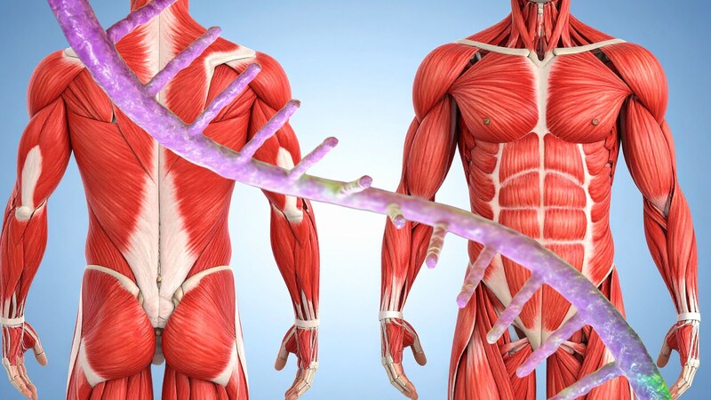 がんが筋肉を奪い激やせさせる仕組み