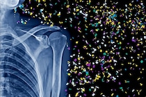 人間の骨の奥深くにマイクロプラスチックを発見