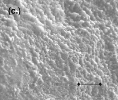 メントスの表面顕微鏡画像。画像中のスケールバーは20μm。