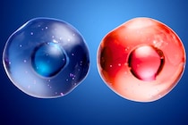 男性細胞と女性細胞が混ざり合っていた殺人被害者――法医学が見つけた“二人分のDNA”