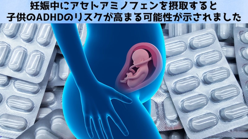 妊娠中にアセトアミノフェンを摂取すると子供のADHDのリスクが高まる可能性がある
