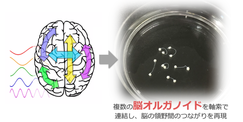 長距離接続がつくる「賢いネットワーク」と、人間性への手がかり