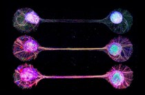 ヒト細胞で作った「ミニ脳」を神経で接続――東京大学が見た「会話する脳オルガノイド」の世界