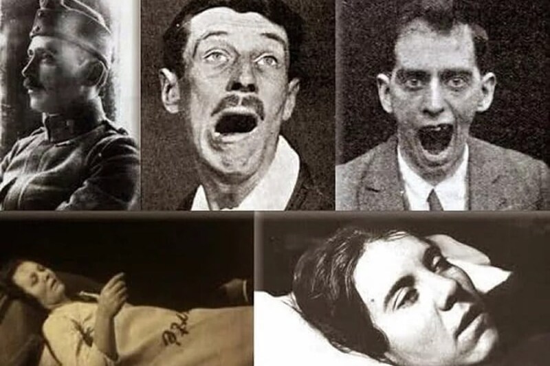 100年前に50万人を死亡させ、忽然と姿を消した「恐怖の感染症」とは？