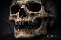 「黒い歯」をもつ2000年前の骸骨、その正体とは？