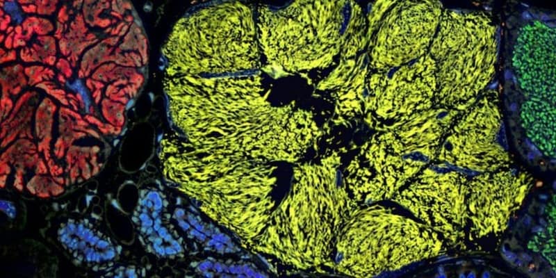 「半分生物で半分細胞部品」のような最小のゲノムを持つ生命体を発見