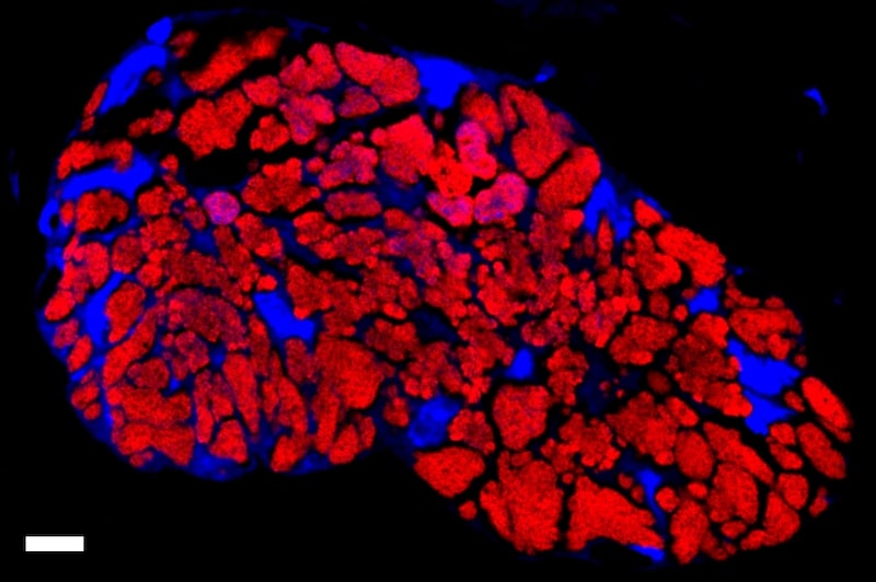 半分生命で半分細胞部品のような存在をどう定義すればいいのか？