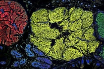 「半分生物で半分細胞部品」のような最小のゲノムを持つ生命体を発見