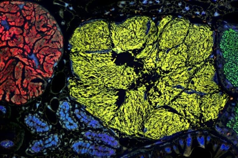 「半分生物で半分細胞部品」のような最小のゲノムを持つ生命体を発見