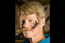 生涯で150種以上の虫に刺されてきた男