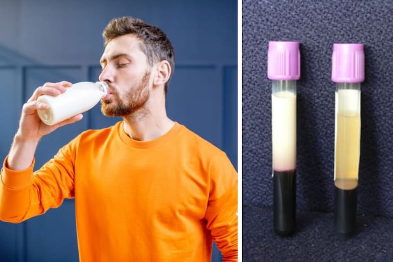 「牛乳を22リットル飲んで緊急搬送された男性」の驚きの症例、血漿がミルク色に