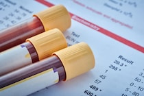 「自殺を考える人」は血中に検出可能な変化があり、しかもその成分は男女で違う