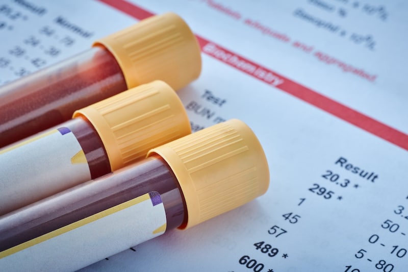 「自殺を考える人」は血中に検出可能な変化があり、しかもその成分は男女で違う