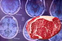 肉を多く食べていると遺伝的にアルツハイマー病になりやすい人も認知症リスクが低くなっていた