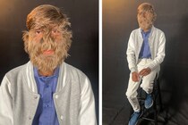 ギネス記録の世界一毛深い顔を持つ青年【10億人に1人】