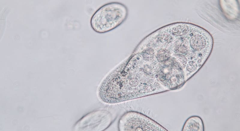 繊毛虫は何を取り込んでしまったのか？