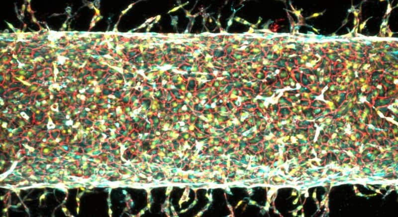 MITが磁石を使って人工血管を培養することに成功