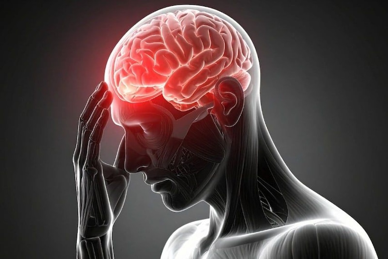 片頭痛患者の「記憶や感情に関わる66領域」で脳老化を確認