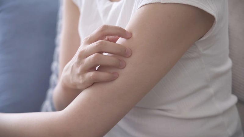 【夏のお悩み】虫刺されの種類と症状一覧！ 正しい対処と予防法