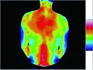 Recoverypro Lab. サーモグラフィー測定結果