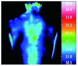 Recoverypro Lab. サーモグラフィー測定結果