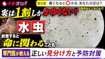 【かゆくない水虫が9割？】専門医に聞く、足以外にも広がる意外な症状と今日からできる予防法