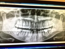 【マジかよ】「歯ブラシを水洗いしない方がいい」って本当か？ 歯科医師に聞いてみた結果 → 全然違った