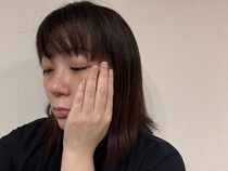 やめたらどうなる？ 美容医療をストップして4ヶ月…肌に起きた変化について【40代女子の自腹レボリューション第24回】