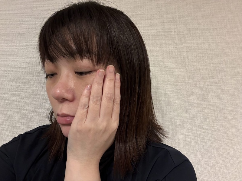 やめたらどうなる？ 美容医療をストップして4ヶ月…肌に起きた変化について【40代女子の自腹レボリューション第24回】