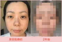 【検証2年】美容医療に約30万かけて肌はどう変わったかのビフォーアフター公開！【40代女子の自腹レボリューション第23回】
