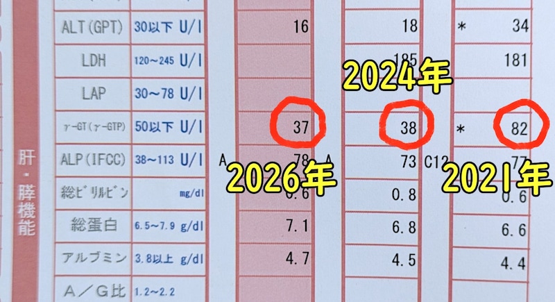 10年の運動習慣で肝臓の数値激変 / 2017年比「ガンマ値 252→37」への超改善と、AI予測の「運動しなかった未来」の恐怖