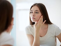 ニキビパッチは本当に効く？効果・種類・正しい貼り方を美容皮膚科医が解説