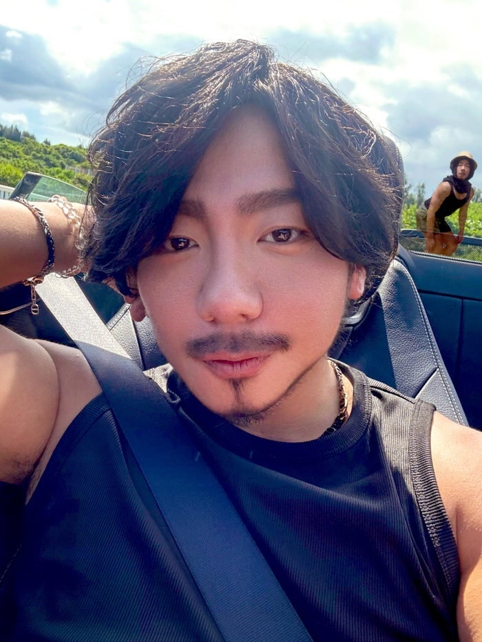 カマたく、人中短縮&眉下切開整形のビフォーアフター公開「印象ぜんぜん違う」「努力がすごすぎる」の声