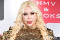 “整形総額1億円超え”アレン様、月の美容費は「140〜150万円」唇ヒアルロン酸注射事情もぶっちゃけ「針穴から漏れ出るくらい…」