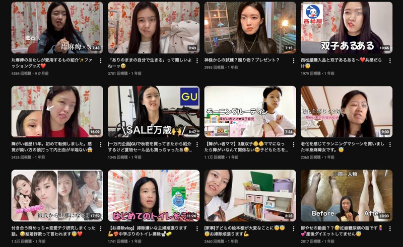 14歳で顔面麻痺「こんな顔で生きられない」「人生終わったな」と絶望した私が、モデルを目指す理由