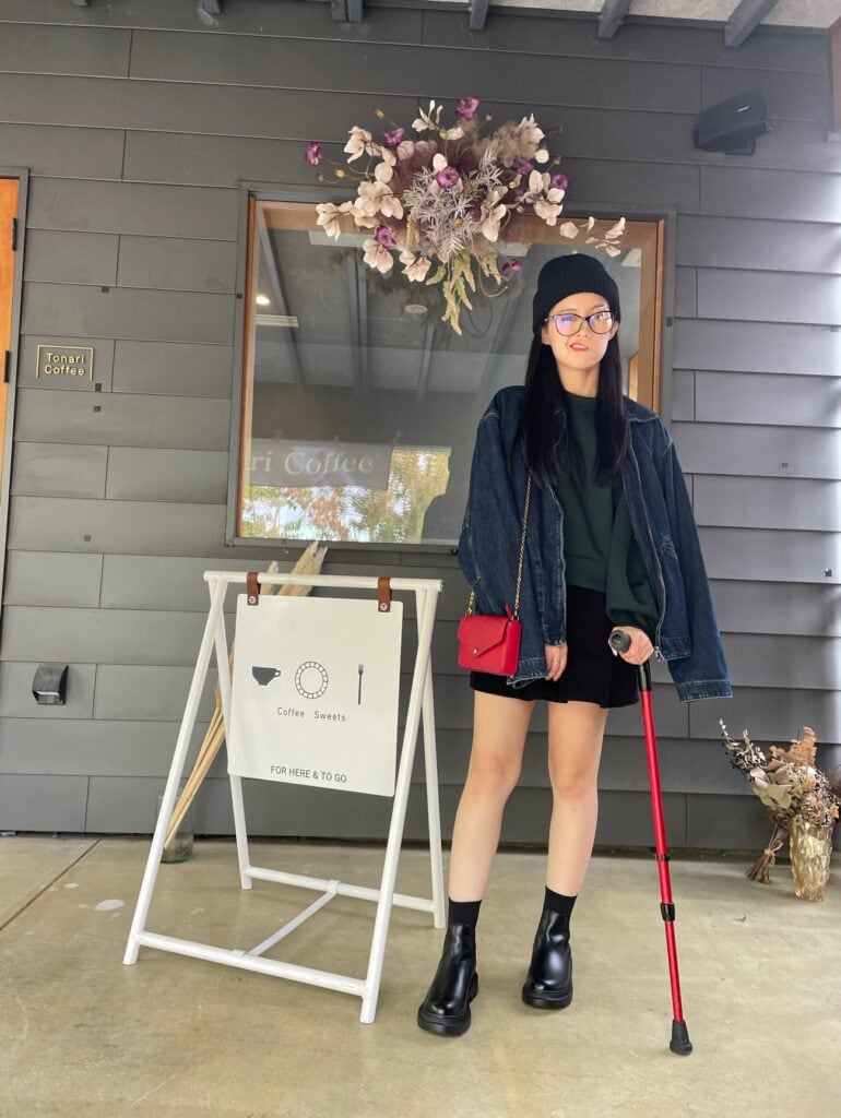 14歳で顔面麻痺「こんな顔で生きられない」「人生終わったな」と絶望した私が、モデルを目指す理由