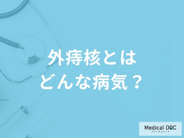 「外痔核」を発症すると現れる症状はご存知ですか？なりやすい人の特徴も解説！