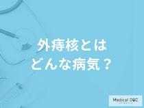 「外痔核」を発症すると現れる症状はご存知ですか？なりやすい人の特徴も解説！