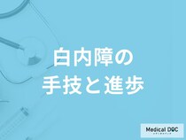 「白内障手術」はどのように進歩しているのか？治療法を医師が解説！【医師監修】