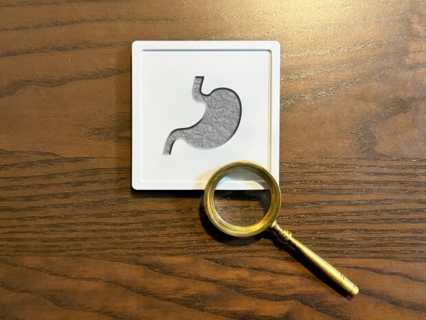 胃GISTのステージ分類