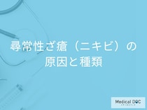 「尋常性ざ瘡（ニキビ）」には種類がある？原因となりやすい人の特徴を医師が解説！