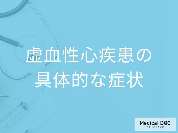 「虚血性心疾患」になるとどんな症状が現れるかご存知ですか？医師が解説！