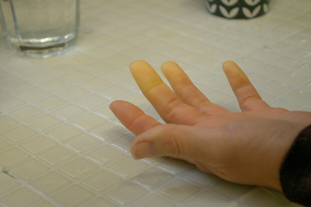 痛みで一睡もできない日々が続き入院を決意