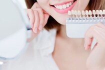 セルフホワイトニングサロンと歯科で受けるホワイトニングを徹底比較！