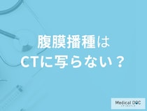 「腹膜播種はCT検査」では写らない？その理由と検査方法を医師が解説！