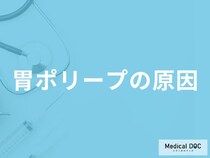 「胃ポリープができる原因」はご存知ですか？医師が解説！
